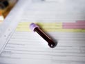 WADA признало неэффективность лабораторных анализов на допинг WADA признало неэффективность лабораторных анализов на допинг