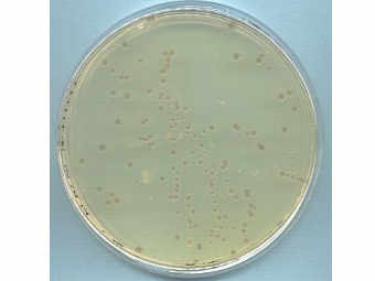 ������� Escherichia coli �� ����� �����. ���� � ����� strubiol.icr.ac.uk