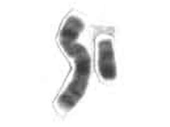 ������� (������) � ������� (�����) ������� ��������� ��������. ����������� National Human Genome Research Institute 