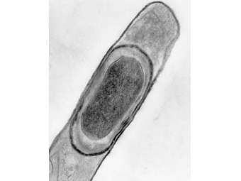 ������ Bacillus licheniformis. ���� � ����� kenyon.edu