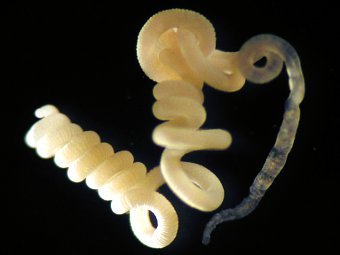 Olavius algarvensis. Фото C. Lott/HYDRA/ Max Planck Institute for Marine Mikrobiology, Bremen